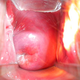 Illustration for article titled Why the Cervix Is More Amazing Than You Realized